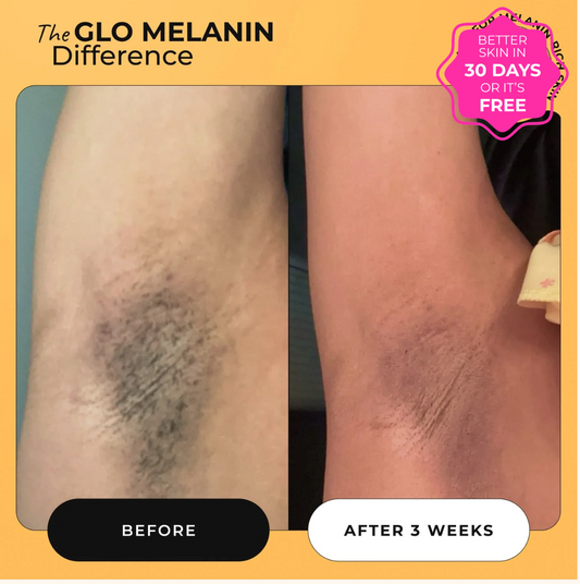 Turmeric Dark Spot Removal Scrub