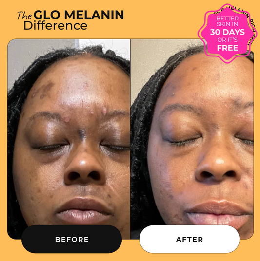 Dark Spot Corrector Serum