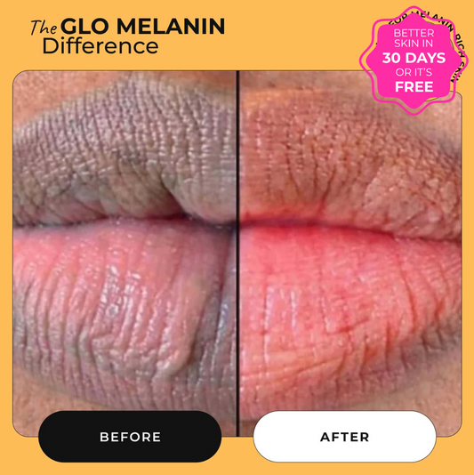 Turmeric and Lemon Lip Balm (for Dark Lips)