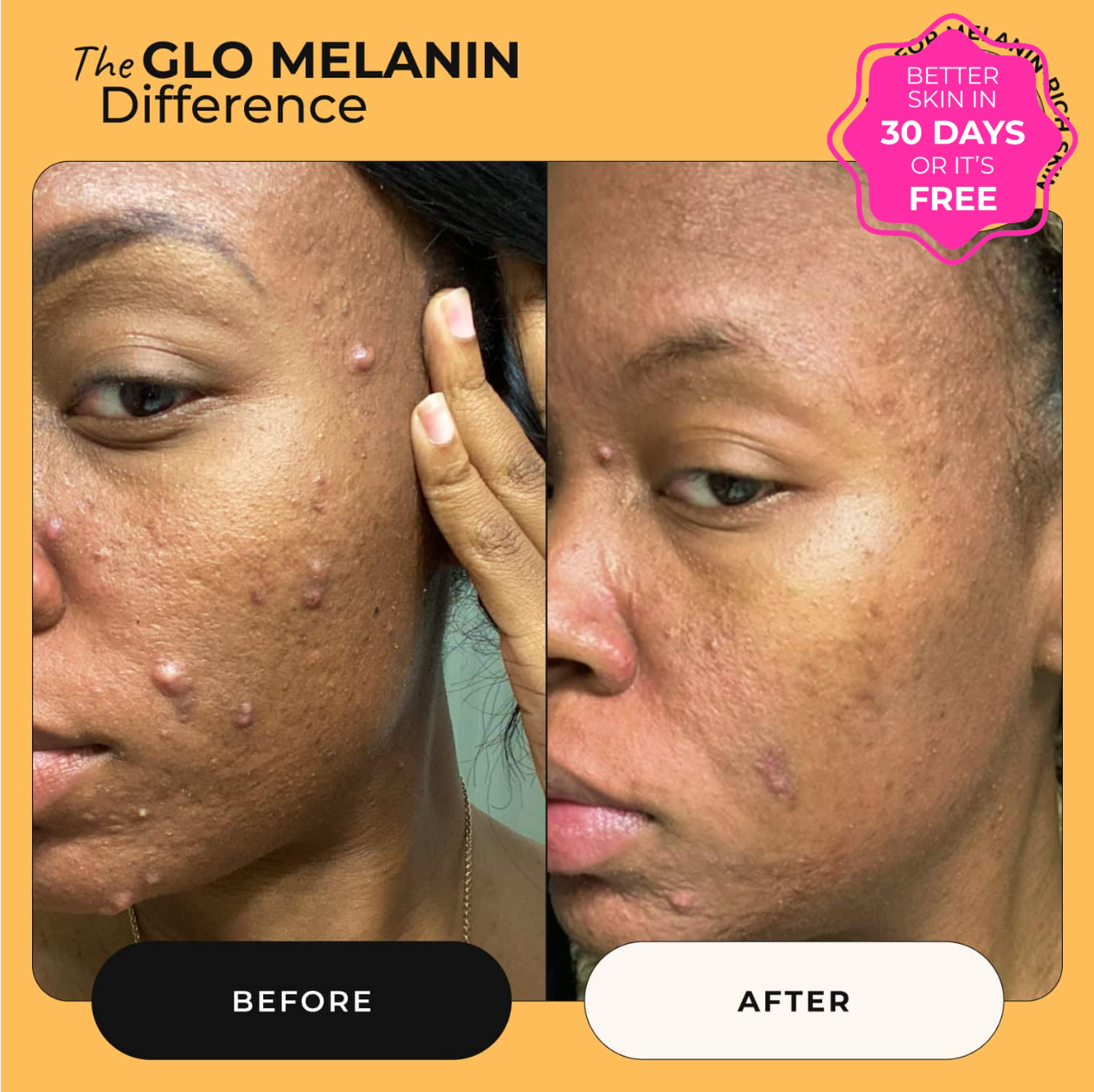 Turmeric and Kojic Foaming Face Wash