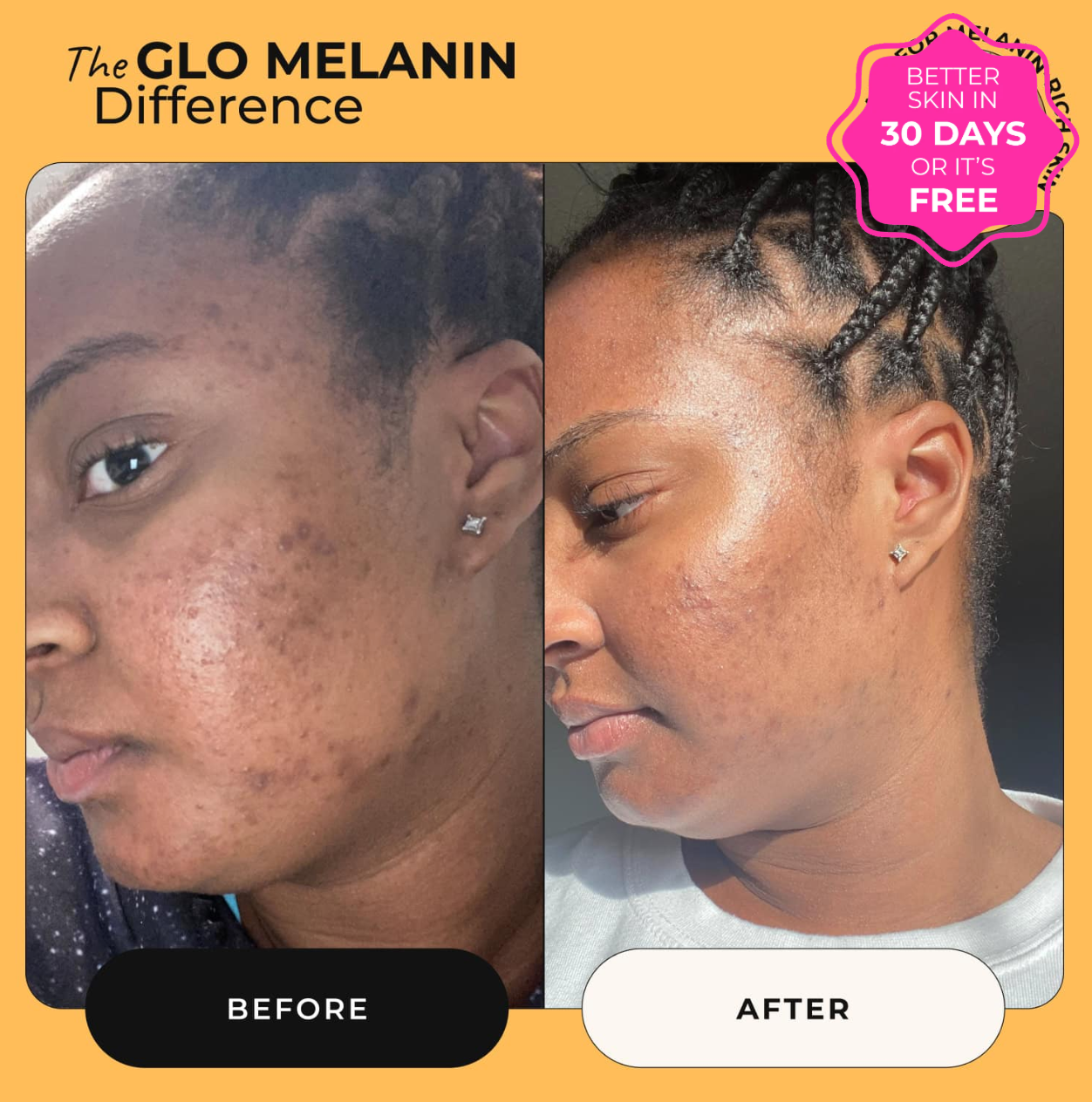 Turmeric and Kojic Foaming Face Wash