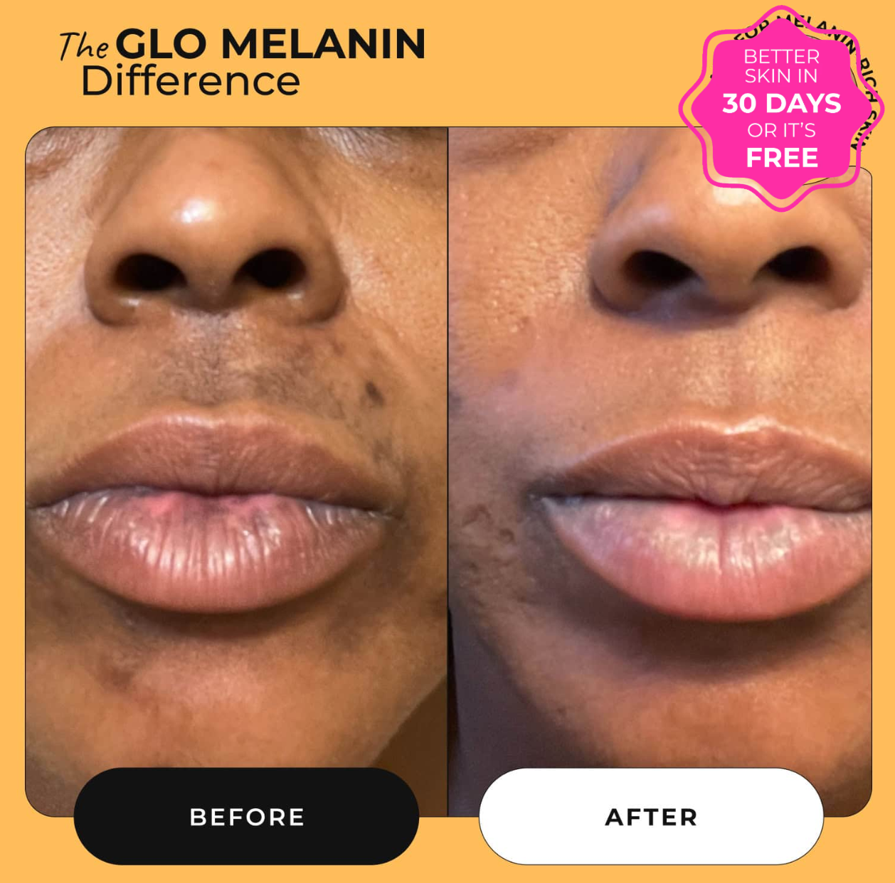 Turmeric and Lemon Lip Balm (for Dark Lips)